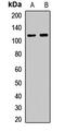 N-Acetyltransferase 10 antibody, LS-C668383, Lifespan Biosciences, Western Blot image 
