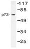 Tumor Protein P73 antibody, AP20512PU-N, Origene, Western Blot image 