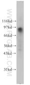FMR1 Autosomal Homolog 2 antibody, 12552-1-AP, Proteintech Group, Western Blot image 