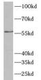 Nectin Cell Adhesion Molecule 1 antibody, FNab09886, FineTest, Western Blot image 