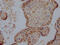 DNA Methyltransferase 1 antibody, CSB-RA160202A0HU, Cusabio, Immunohistochemistry frozen image 