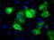 Glutamate-Ammonia Ligase antibody, NBP2-02125, Novus Biologicals, Immunocytochemistry image 