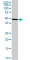 4-Hydroxyphenylpyruvate Dioxygenase antibody, LS-C197453, Lifespan Biosciences, Western Blot image 