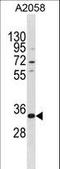 Homeobox protein TGIF2LX antibody, LS-C157180, Lifespan Biosciences, Western Blot image 
