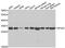Ribosomal Protein S4 X-Linked antibody, LS-C334907, Lifespan Biosciences, Western Blot image 