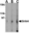  antibody, LS-B3215, Lifespan Biosciences, Western Blot image 