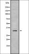 Centromere Protein K antibody, orb337855, Biorbyt, Western Blot image 