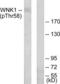 WNK1 antibody, LS-C199735, Lifespan Biosciences, Western Blot image 