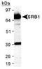 Scavenger Receptor Class B Member 1 antibody, PA1-16788, Invitrogen Antibodies, Western Blot image 