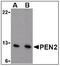 Presenilin Enhancer, Gamma-Secretase Subunit antibody, AP22868PU-N, Origene, Western Blot image 