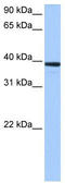 Mitochondrial RRNA Methyltransferase 1 antibody, TA343933, Origene, Western Blot image 