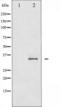 FosB Proto-Oncogene, AP-1 Transcription Factor Subunit antibody, TA325468, Origene, Western Blot image 