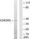 Cyclin-dependent kinase 5 activator 2 antibody, TA314840, Origene, Western Blot image 