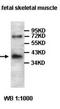 Oxoglutarate Dehydrogenase antibody, orb77667, Biorbyt, Western Blot image 