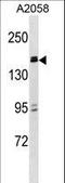 Zinc Finger And BTB Domain Containing 38 antibody, LS-C160723, Lifespan Biosciences, Western Blot image 