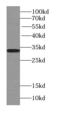 Thiosulfate Sulfurtransferase antibody, FNab09074, FineTest, Western Blot image 