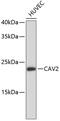 Caveolin-2 antibody, 13-798, ProSci, Western Blot image 