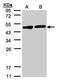 Creatine Kinase B antibody, GTX101760, GeneTex, Western Blot image 