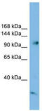 Serine/threonine-protein phosphatase 4 regulatory subunit 3A antibody, TA344651, Origene, Western Blot image 