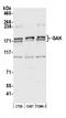 Cyclin G Associated Kinase antibody, A304-268A, Bethyl Labs, Western Blot image 