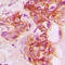 CD40 Molecule antibody, LS-C351964, Lifespan Biosciences, Immunohistochemistry paraffin image 