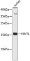 Histidine triad nucleotide-binding protein 1 antibody, 19-207, ProSci, Western Blot image 
