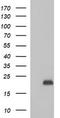Phospholipase A And Acyltransferase 3 antibody, CF506909, Origene, Western Blot image 