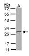 MGC40579 antibody, orb69923, Biorbyt, Western Blot image 