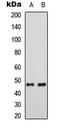Mitochondrial Ribosomal Protein S5 antibody, LS-C356192, Lifespan Biosciences, Western Blot image 