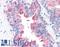 ADAM Metallopeptidase Domain 20 antibody, LS-A8802, Lifespan Biosciences, Immunohistochemistry paraffin image 