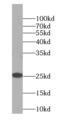 Single-Pass Membrane Protein With Coiled-Coil Domains 3 antibody, FNab01014, FineTest, Western Blot image 