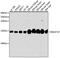 NADH:Ubiquinone Oxidoreductase Subunit A7 antibody, GTX65602, GeneTex, Western Blot image 