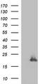 Phospholipase A And Acyltransferase 3 antibody, TA506911S, Origene, Western Blot image 