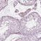 Keratin 28 antibody, NBP2-57281, Novus Biologicals, Immunohistochemistry frozen image 