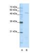 Seryl-TRNA Synthetase antibody, NBP1-57539, Novus Biologicals, Western Blot image 