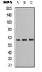 Angiopoietin Like 1 antibody, LS-C413324, Lifespan Biosciences, Western Blot image 