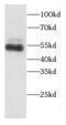 SYNCAM antibody, FNab01190, FineTest, Western Blot image 
