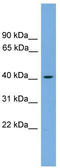 Sterol O-acyltransferase 1 antibody, TA336252, Origene, Western Blot image 
