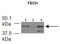 Ferrochelatase, mitochondrial antibody, TA346162, Origene, Western Blot image 