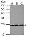 Ribosomal Protein L9 antibody, GTX114728, GeneTex, Western Blot image 