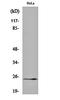 Kallikrein Related Peptidase 11 antibody, orb159381, Biorbyt, Western Blot image 