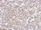 NADH:Ubiquinone Oxidoreductase Subunit AB1 antibody, LS-C186233, Lifespan Biosciences, Immunohistochemistry paraffin image 