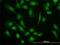 Eukaryotic Translation Initiation Factor 4 Gamma 1 antibody, H00001981-M10, Novus Biologicals, Immunofluorescence image 