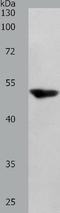 Serpin Family F Member 1 antibody, TA321510, Origene, Western Blot image 