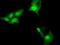 LRAT Domain Containing 2 antibody, MA5-25224, Invitrogen Antibodies, Immunocytochemistry image 