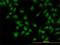 CDC Like Kinase 3 antibody, H00001198-M04, Novus Biologicals, Immunofluorescence image 