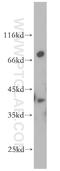 Docking Protein 6 antibody, 14108-1-AP, Proteintech Group, Western Blot image 
