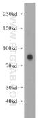 BM-90 antibody, 20425-1-AP, Proteintech Group, Western Blot image 
