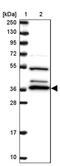3'(2'), 5'-Bisphosphate Nucleotidase 1 antibody, PA5-61743, Invitrogen Antibodies, Western Blot image 