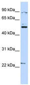 X-Linked Kx Blood Group antibody, TA334282, Origene, Western Blot image 